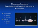 Mark Latina, M.D. Discusses Glaucoma Tube Shunt Technology – AAO 2012