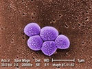 An Update on Methicillin-Resistant Staphylococcus