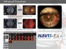 The Marco AFC-330 Retinal Camera:  A New Dimension to Clinical Efficiency