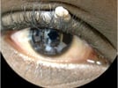 Slit Lamp Adapters turn Smartphones into Clinical Cameras
