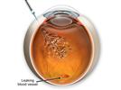 New Perspectives on Macular Degeneration Therapies