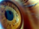 Glaucoma Laser Surgery