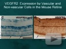Webinar: Blood Vessel Growth and Maturation
