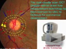 Webinar: Doppler OCT Measurement of Retinal Blood Flow