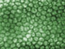Reimbursement Considerations for Specular Microscopy