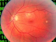Digital Fundus Photography:  Once Esoteric, Now Essential