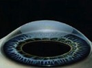 What to Expect When You’re Expecting a Good Cornea Fellowship