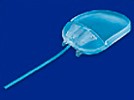 YAG Laser Cataract Surgery