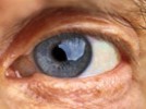 Visual Testing for Cataracts