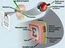 Top 5 Promising Technologies in Ophthalmology