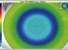 OCULUS Keratograph: OxiMap – Visualizing Oxygen Transmissibility of Soft Contact Lenses