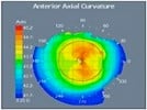 2010 Ophthalmology in Review:  Anterior Segment