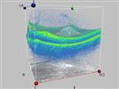 3-D in Ophthalmology