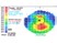 A 58-year-old man with the following corneal topography map is undergoing cataract surgery OD.  What would be your advice to him regarding corneal relaxing incisions to reduce his astigmatism?