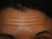 A patient comes to your office requesting cosmetic Botox.  She is bothered by the wrinkles in the area depicted in the image.  Which muscle would you need to target with your injections to address these rhytides? 