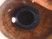 Which of the following is not a risk factor for the condition shown in the photo?