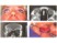 The patient in the photos below is a 45 yo female with complaints of a bulging right eye that has been gradual over the past several years.  She denies pain or double vision.  Her CT scans are shown below as well as the surgical removal of the tumor.  What is the most likely diagnosis?