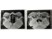 The CT scan below is most representative of which of the following disease processes?