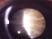 Which type of cataract is associated with an increased risk of capsular rupture during surgery?