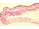 The correct order for the layers of the upper eyelid from anterior to posterior is: