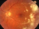 The most appropriate test to obtain for this patient is: