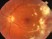 The most appropriate test to obtain for this patient is: