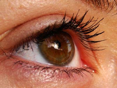 Treatment of Blepharitis