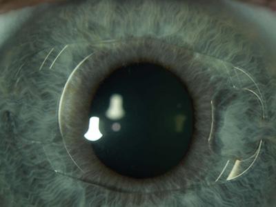 Phakic Intraocular Lenses: A review