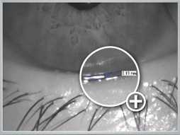 Measured tear meniscus height