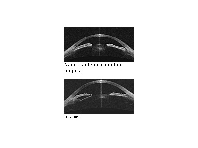 Angle-to-angle Distance