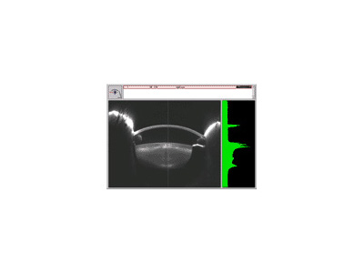 Scheimpflug Image