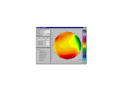 Corneal Topography