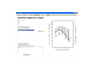 EyeView® software output pictorially demonstrating a patient's contrast sensitivity curve.
