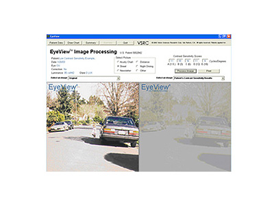 Image at left displays normal functional vision. Image at right demonstrates the low normal patient's vision model during bright daylight driving conditions.