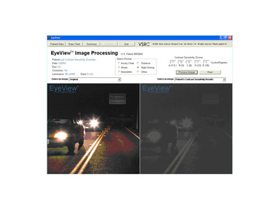 Image at left displays normal functional vision. Image at right demonstrates the low normal patient's vision during night driving conditions.