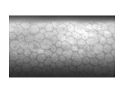 Image Sample: Normal Cells