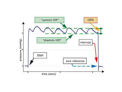 This is what the PASCAL® tonometer measures