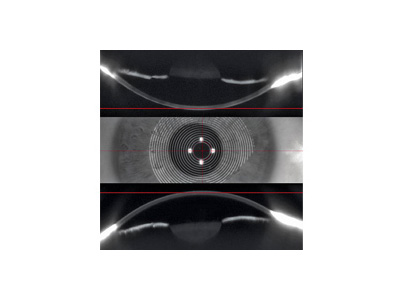 Merging of Placido and Scheimpflug data