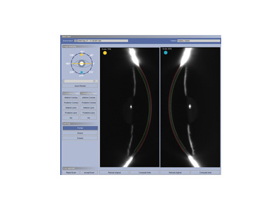 Pachymetry