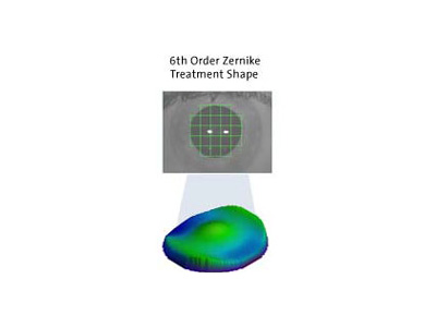 More Precise Ablation Shapes Than Ever