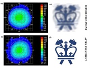 New Non-Invasive Method May Treat Nearsightedness
