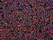 Stem Cell-Based Therapy for Blinding Eye Diseases Receives Research Funding