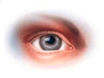 BD Beaver™ Fixation Rings