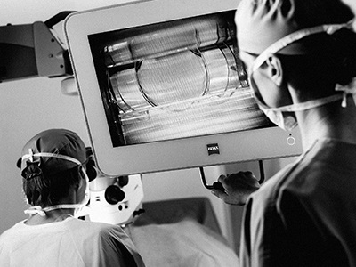 Accommodating Intraocular Lenses (IOL) | OphthalmologyWeb: The Ultimate ...