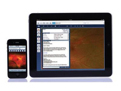 Optos Advanced Icon OptosAdvance™ Data Management System from Optos, Inc. - Product ...